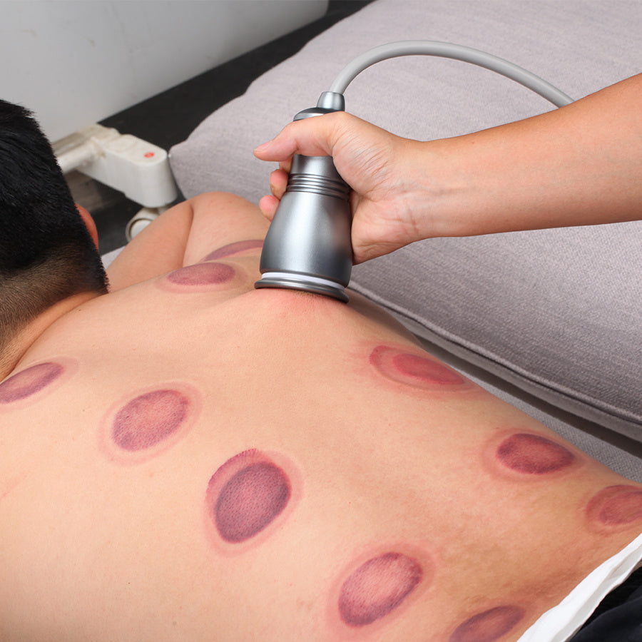 Household Electric Negative Pressure Scraping Instrument Cupping Massage Meridian Dredging
